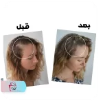 استفاده از قرص فیتو